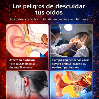 🔎 Limpiador de Cerumen con Cámara (Otoscopio digital)